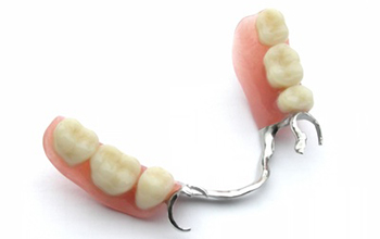 Partial Denture with Metal